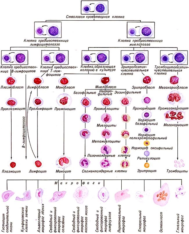 схема гемобластозов 