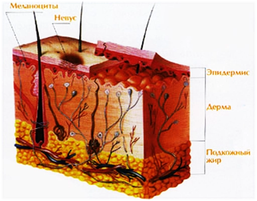 строение кожи с невусом 