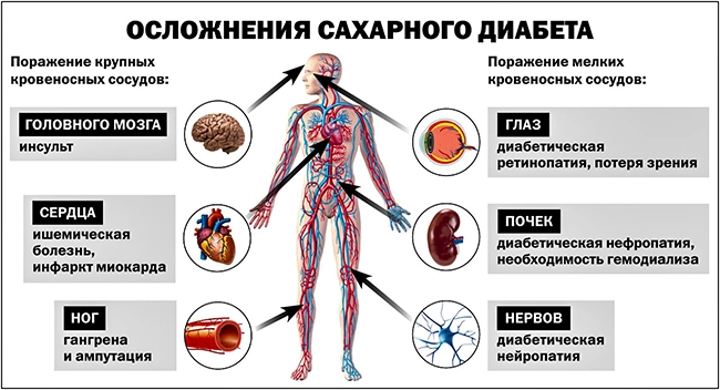 осложнения сахарного диабета