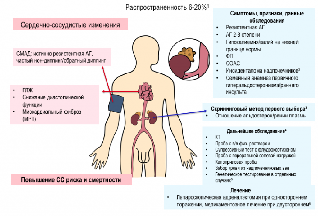 первичный альдостеронизм