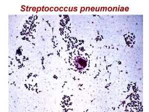 S. pneumoniae