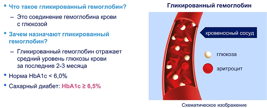 Школа сахарный диабет 2тип - 6