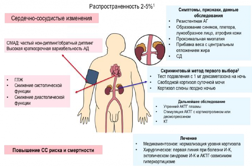 Синдром Иценко Кушинга