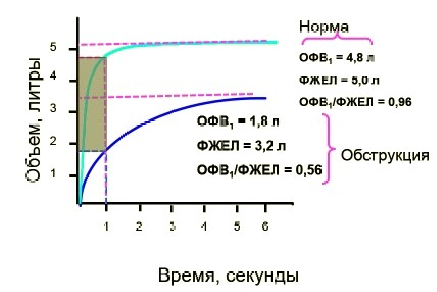 Изменение дыхательных объемов при обструкции